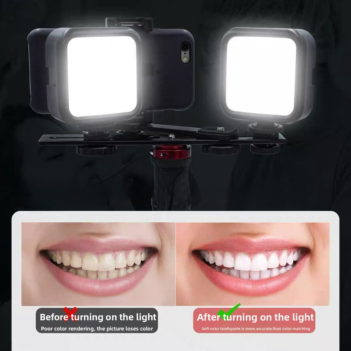 Bluetooth搭載歯科用写真撮影ライト 口腔内写真照明  - Photography Basics のレビューと価格