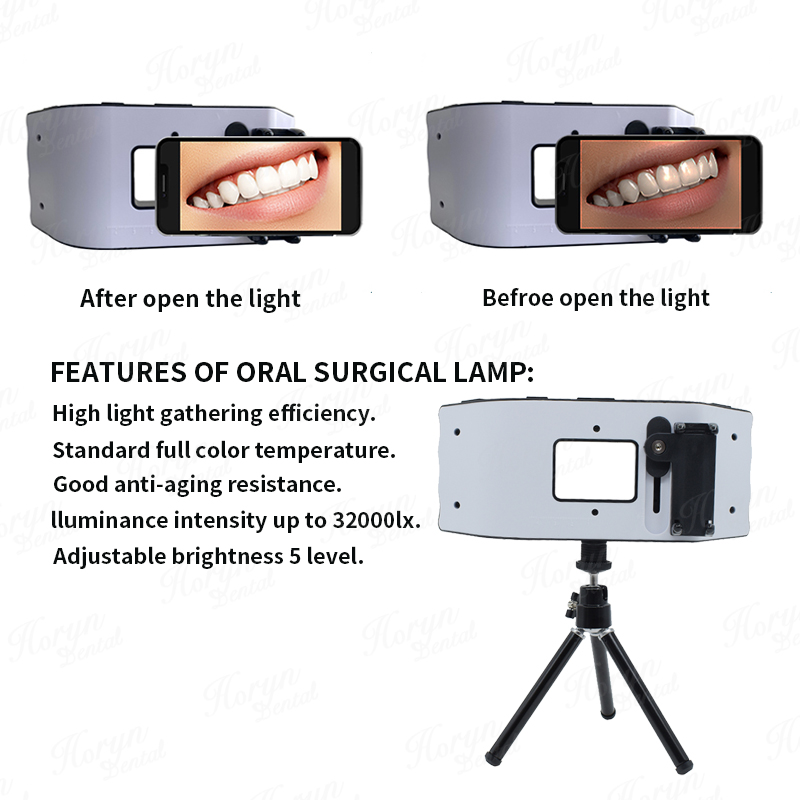 歯科用フラッシュライト,歯科医の写真機器,LED口腔充填ライ - Photography Equipment のレビューと価格